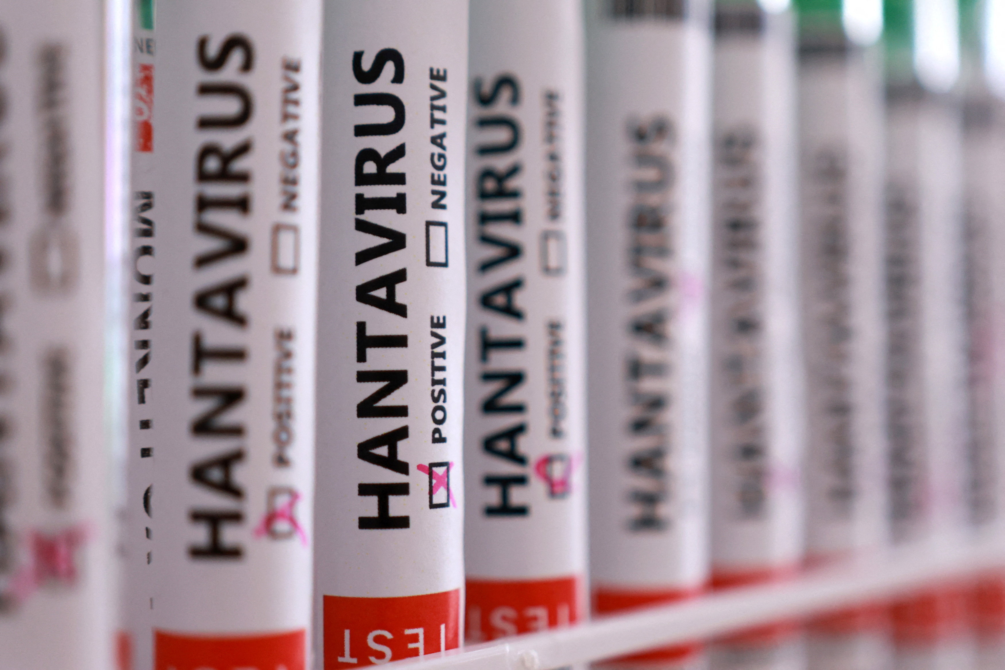 Türkiye'de hantavirüs vakası var mı? Sağlık Bakanlığı'ndan açıklama